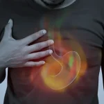 What Is Acid Reflux? A Simple Overview